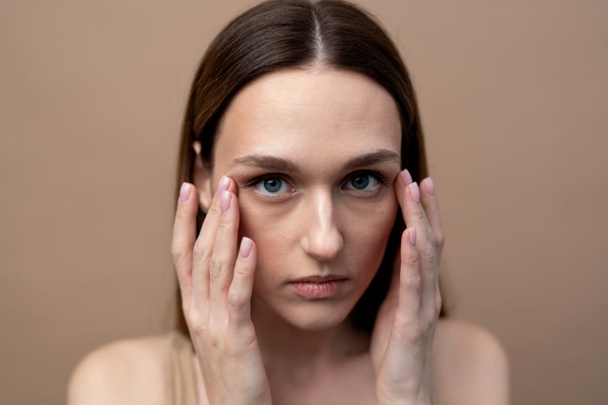 Wrinkles around the eyes in your 20s — Alix Avien blog image