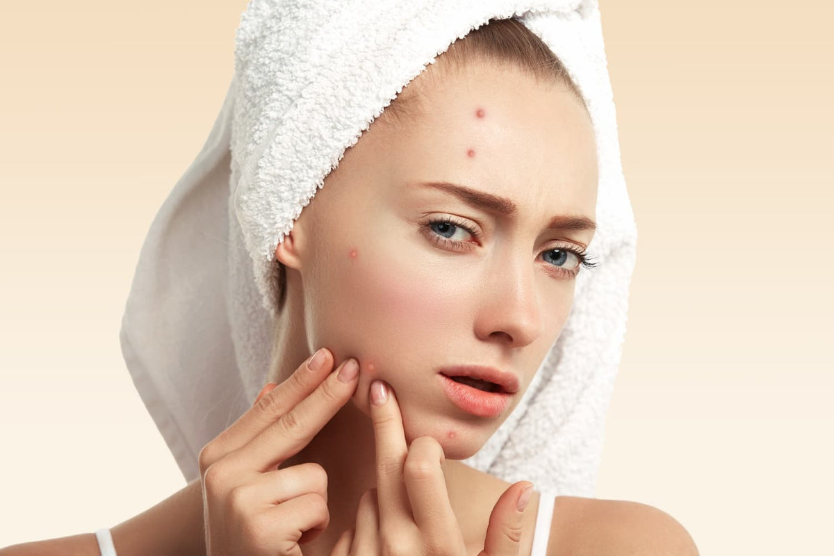 Why Do I Break Out When I Wear Makeup — Alix Avien blog image